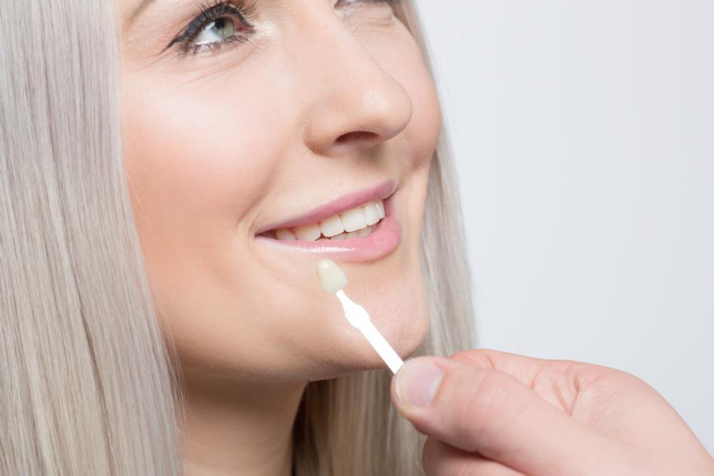 a woman gets a veneer matched to her teeth | Evansville IN dentist