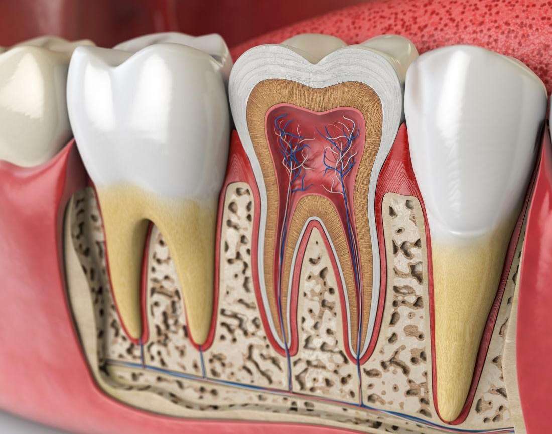 How Fast Does a Root Canal Infection Spread? | Endodontics Evansville IN