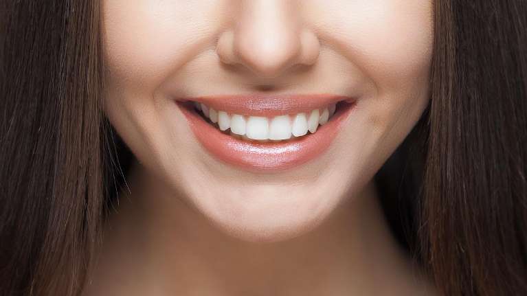 Woman smiling with her white teeth in Evansville TN